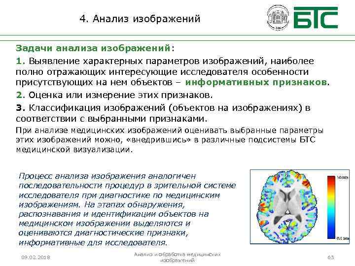 4. Анализ изображений Задачи анализа изображений: 1. Выявление характерных параметров изображений, наиболее полно отражающих