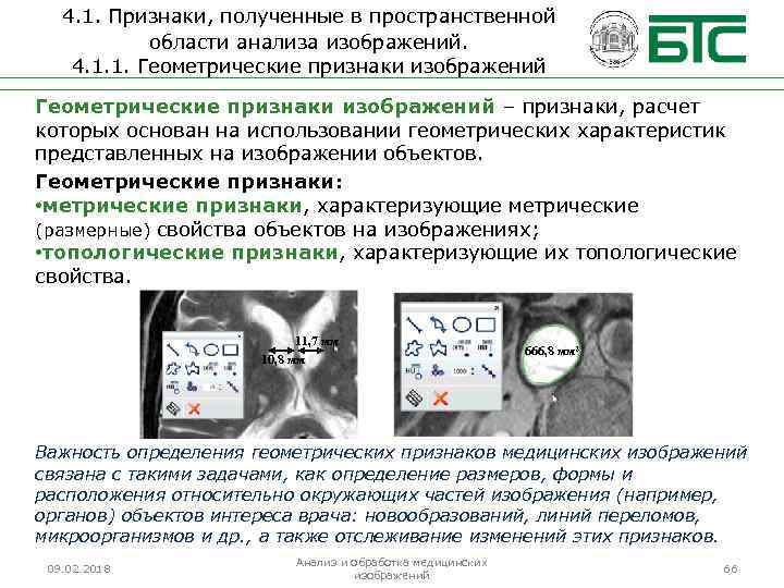 4. 1. Признаки, полученные в пространственной области анализа изображений. 4. 1. 1. Геометрические признаки