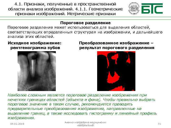 4. 1. Признаки, полученные в пространственной области анализа изображений. 4. 1. 1. Геометрические признаки