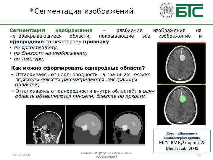 *Сегментация изображений Сегментация изображения – разбиение изображения на неперекрывающиеся области, покрывающие все изображение и