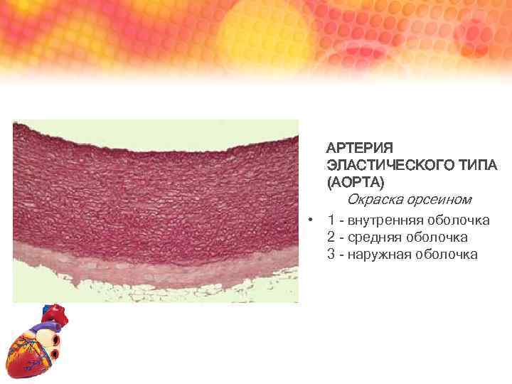 АРТЕРИЯ ЭЛАСТИЧЕСКОГО ТИПА (АОРТА) Окраска орсеином • 1 - внутренняя оболочка 2 - средняя