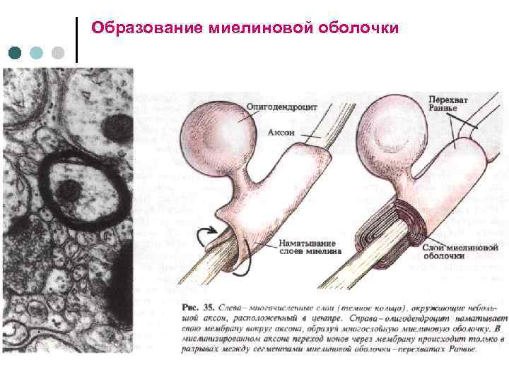 Образование миелиновой оболочки 