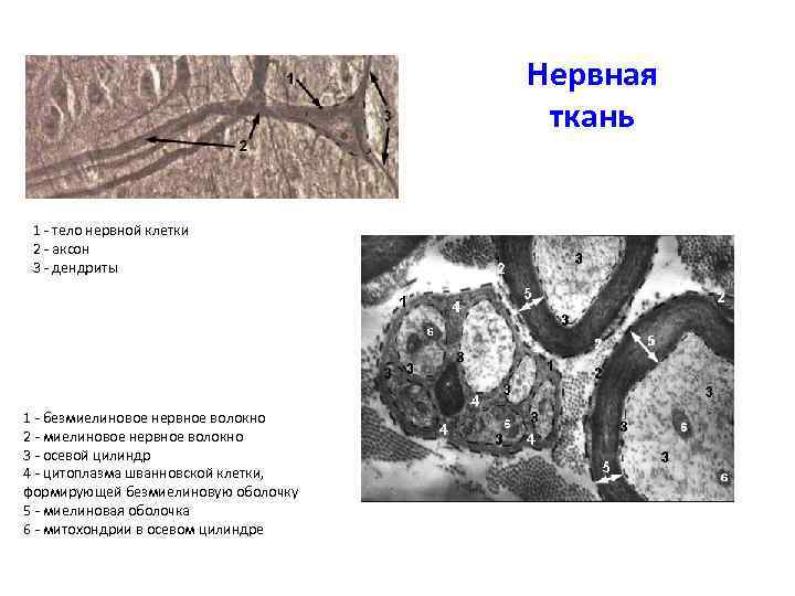 Нервная ткань 1 - тело нервной клетки 2 - аксон 3 - дендриты 1