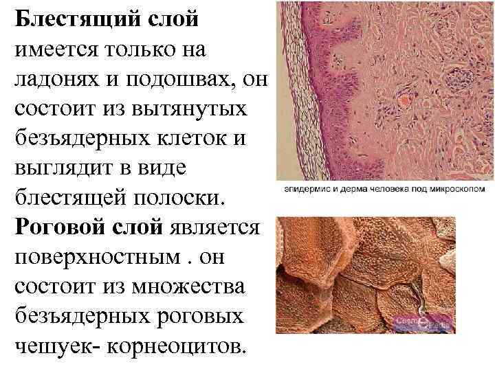 Блестящий слой имеется только на ладонях и подошвах, он состоит из вытянутых безъядерных клеток