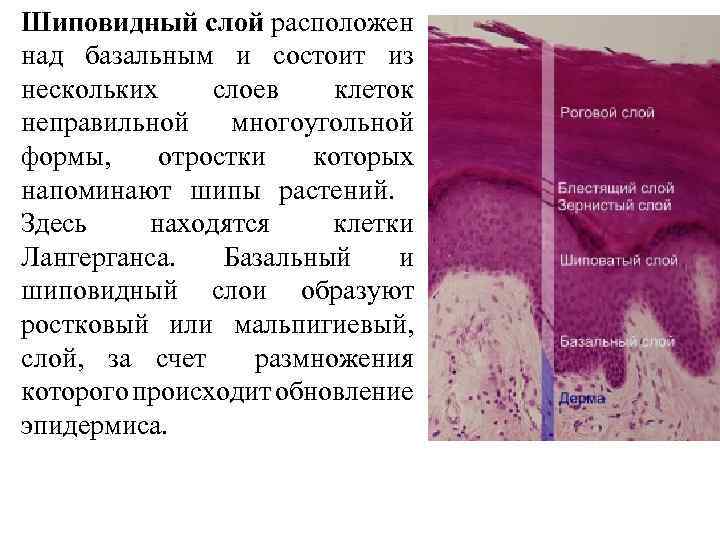 Шиповидный слой расположен над базальным и состоит из нескольких слоев клеток неправильной многоугольной формы,