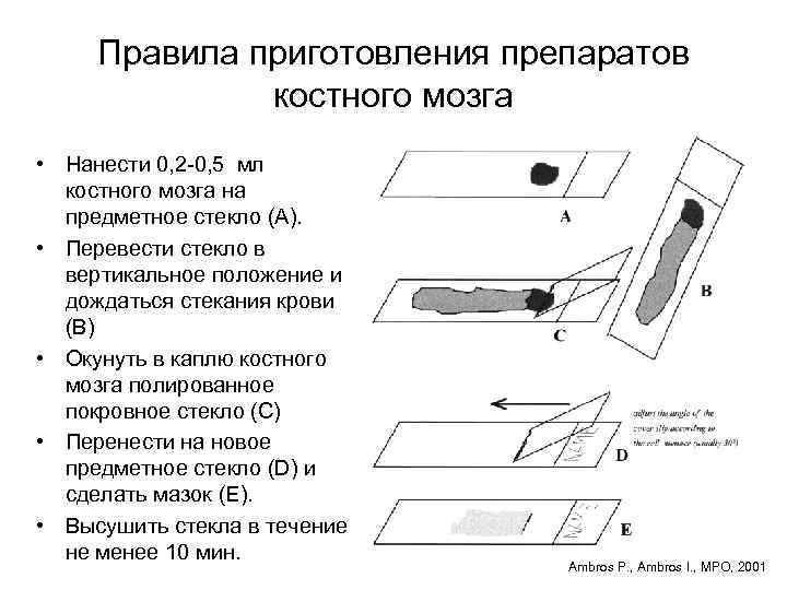 Правила приготовления препаратов костного мозга • Нанести 0, 2 -0, 5 мл костного мозга