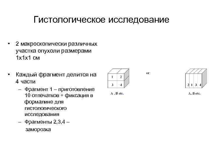 Гистологическое исследование • 2 макроскопически различных участка опухоли размерами 1 х1 х1 см •