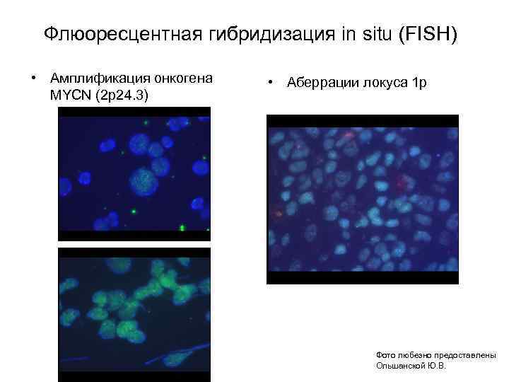 Флюоресцентная гибридизация in situ (FISH) • Амплификация онкогена MYCN (2 р24. 3) • Аберрации