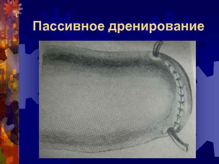 Пассивное дренирование 