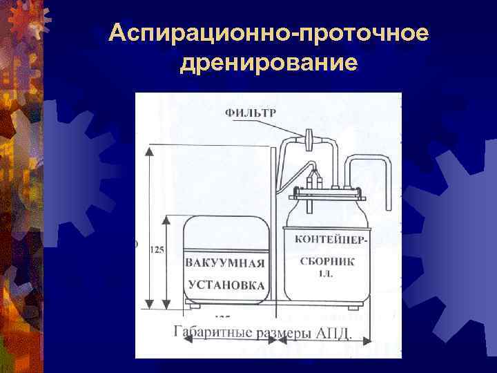 Аспирационно-проточное дренирование 