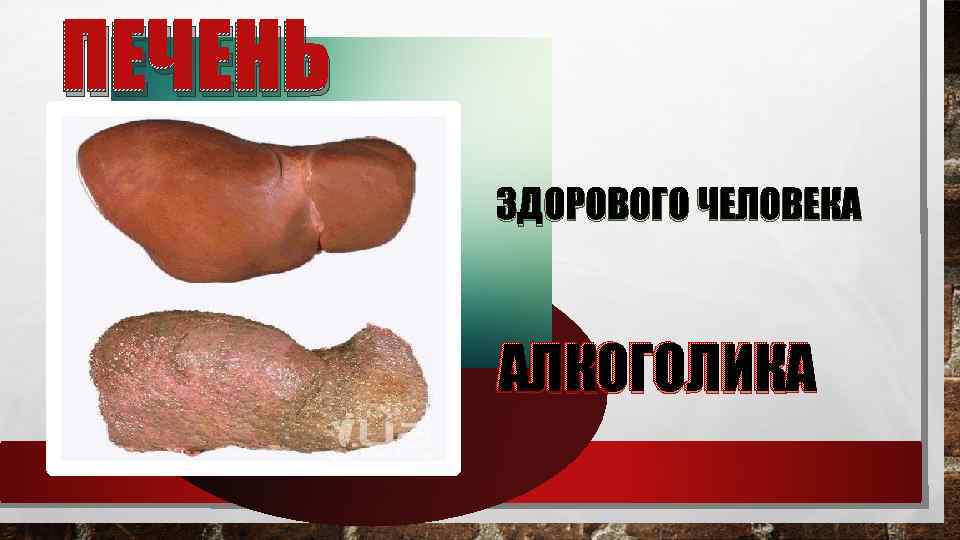 ПЕЧЕНЬ ЗДОРОВОГО ЧЕЛОВЕКА АЛКОГОЛИКА 