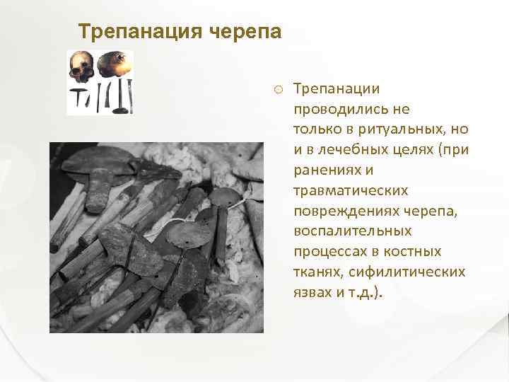 Трепанация черепа Трепанации проводились не только в ритуальных, но и в лечебных целях (при