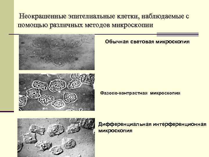 Неокрашенные эпителиальные клетки, наблюдаемые с помощью различных методов микроскопии Обычная световая микроскопия Фазово-контрастная микроскопия