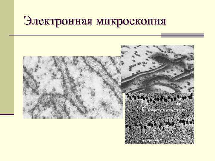 Электронная микроскопия 