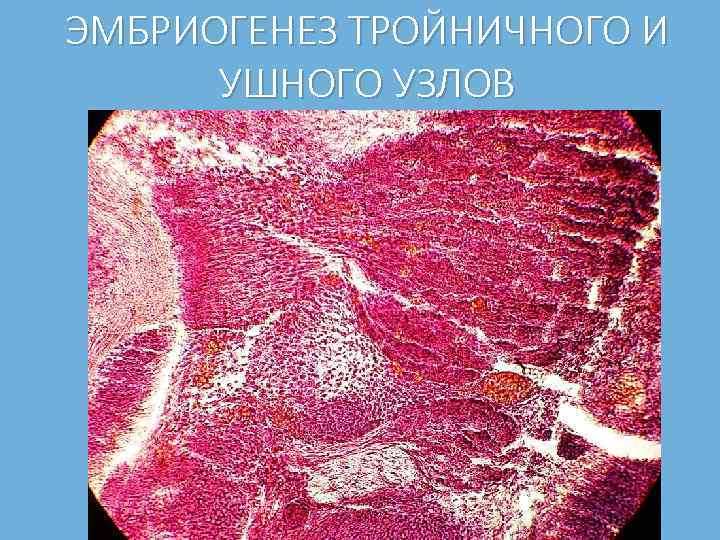 ЭМБРИОГЕНЕЗ ТРОЙНИЧНОГО И УШНОГО УЗЛОВ 