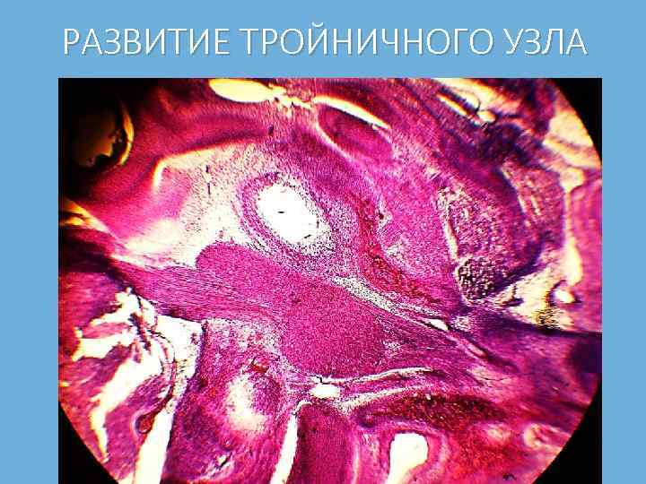 РАЗВИТИЕ ТРОЙНИЧНОГО УЗЛА 