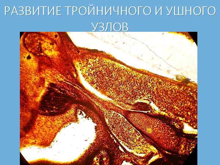 РАЗВИТИЕ ТРОЙНИЧНОГО И УШНОГО УЗЛОВ 