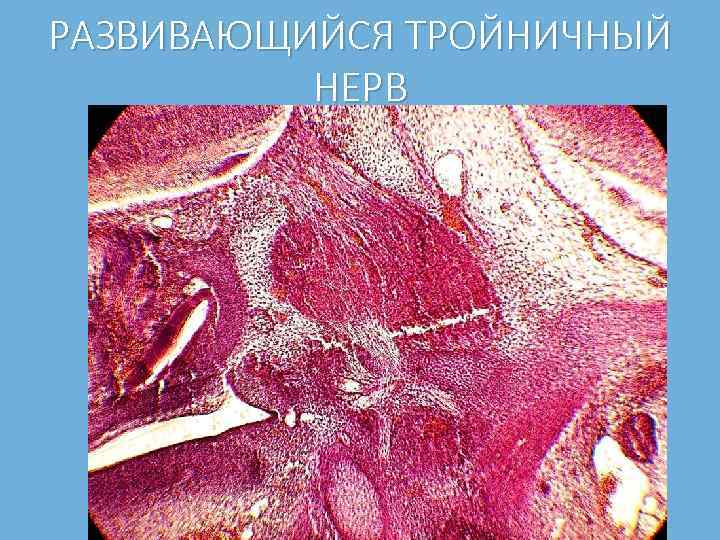 РАЗВИВАЮЩИЙСЯ ТРОЙНИЧНЫЙ НЕРВ 
