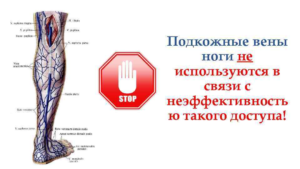 Подкожные вены ноги не используются в связи с неэффективность ю такого доступа! 