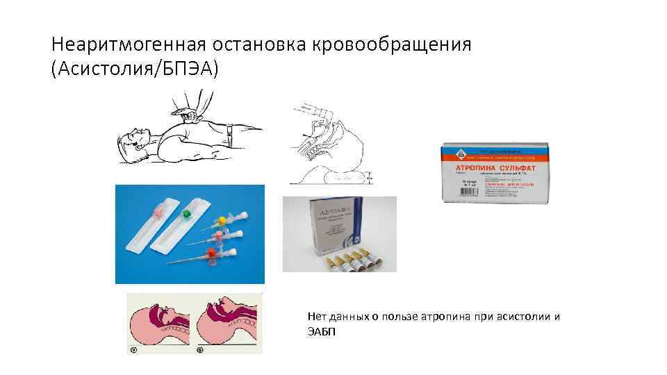 Неаритмогенная остановка кровообращения (Асистолия/БПЭА) Нет данных о пользе атропина при асистолии и ЭАБП 