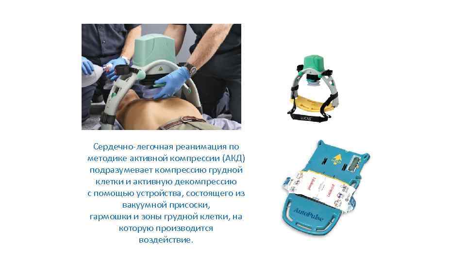 Сердечно-легочная реанимация по методике активной компрессии (АКД) подразумевает компрессию грудной клетки и активную декомпрессию
