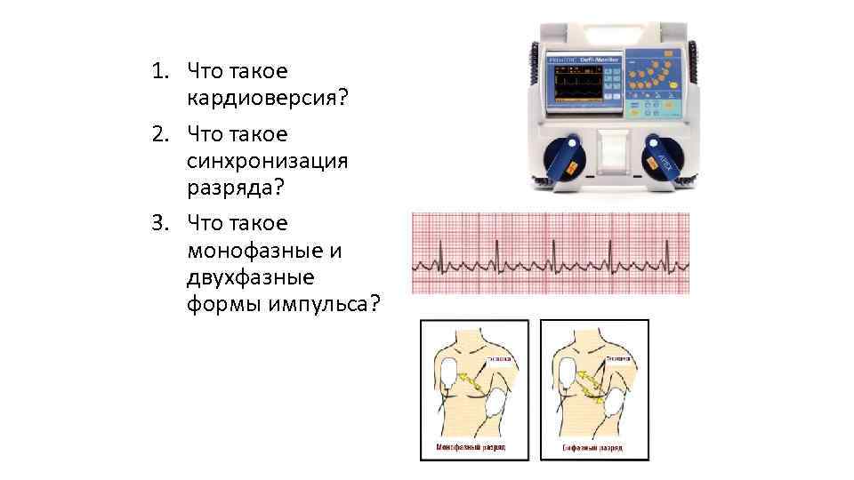 1. Что такое кардиоверсия? 2. Что такое синхронизация разряда? 3. Что такое монофазные и