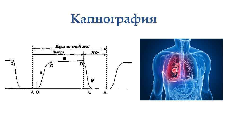 Капнография 