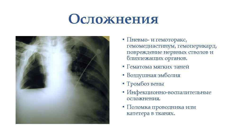 Осложнения • Пневмо- и гемоторакс, гемомедиастинум, гемоперикард, повреждение нервных стволов и близлежащих органов. •
