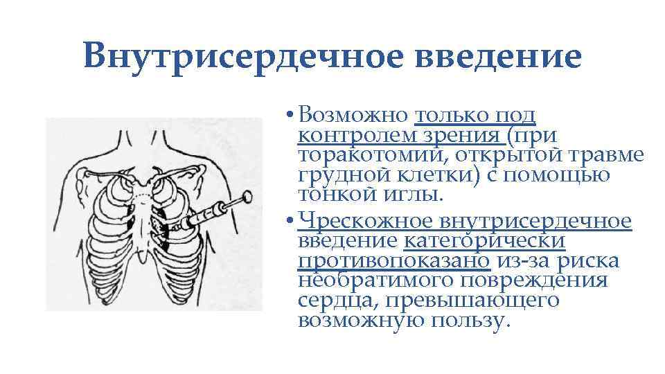 Внутрисердечное введение • Возможно только под контролем зрения (при торакотомии, открытой травме грудной клетки)