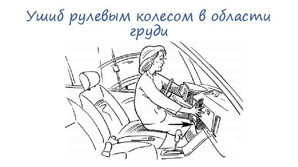 Ушиб рулевым колесом в области груди 
