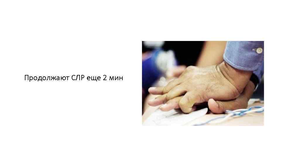 Продолжают СЛР еще 2 мин 