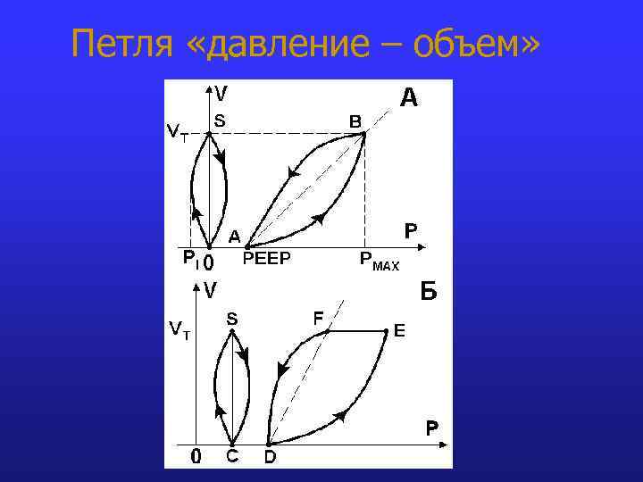 Петля «давление – объем» 