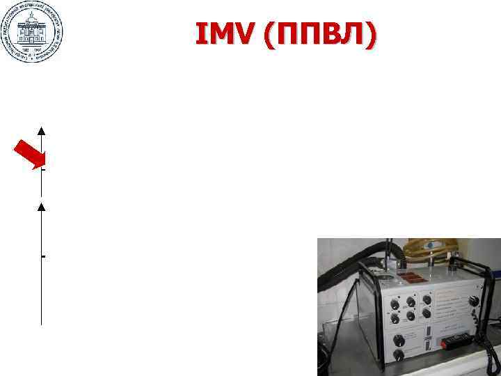 IMV (ППВЛ) 