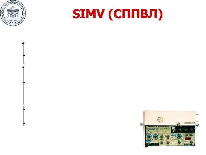 SIMV (СППВЛ) 