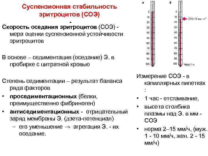 Суспензионная стабильность эритроцитов (СОЭ) - Скорость оседания эритроцитов (СОЭ) - мера оценки суспензионной устойчивости