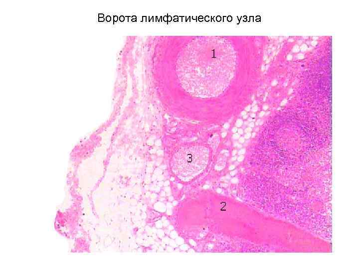 Ворота лимфатического узла 