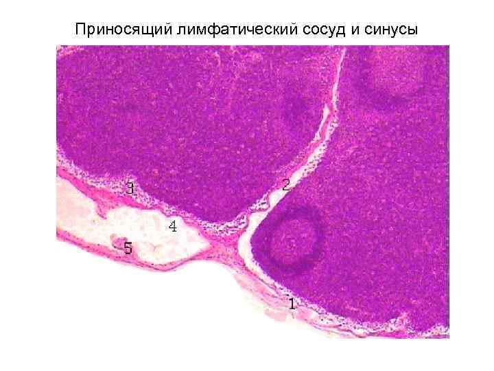 Приносящий лимфатический сосуд и синусы 