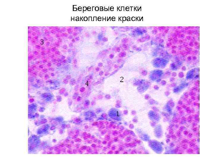 Береговые клетки накопление краски 