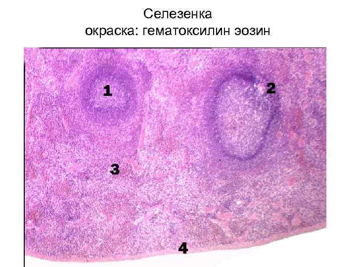 Селезенка окраска: гематоксилин эозин 