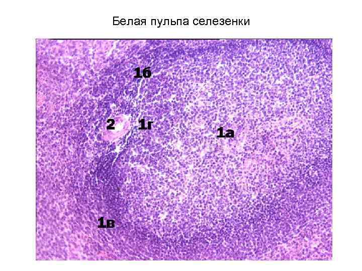 Белая пульпа селезенки 