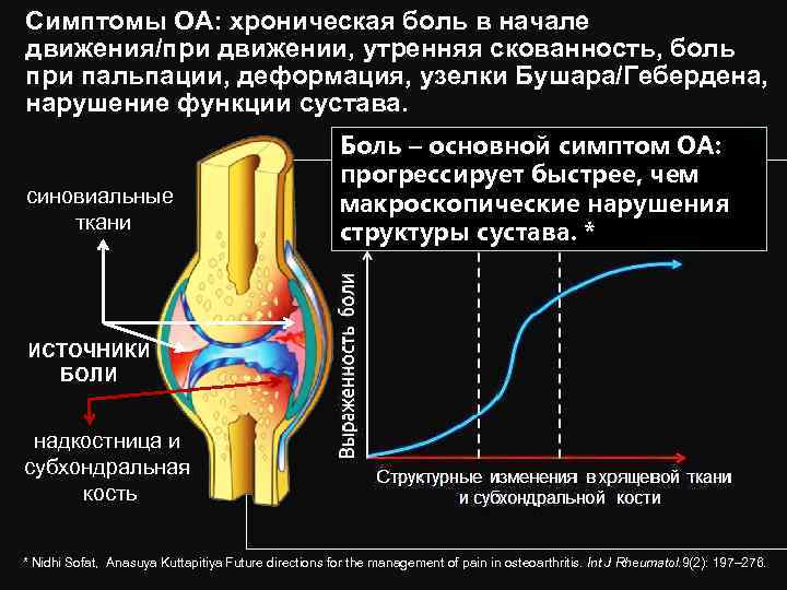 Симптомы ОА: хроническая боль в начале движения/при движении, утренняя скованность, боль при пальпации, деформация,