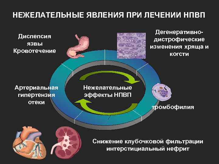 НЕЖЕЛАТЕЛЬНЫЕ ЯВЛЕНИЯ ПРИ ЛЕЧЕНИИ НПВП Дегенеративнодистрофические изменения хряща и когсти Диспепсия язвы Кровотечение Артериальная