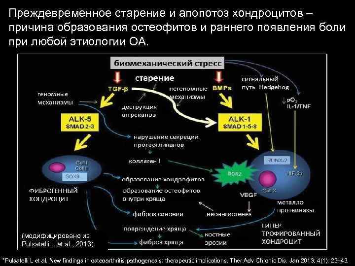 Преждевременное старение и апопотоз хондроцитов – причина образования остеофитов и раннего появления боли при