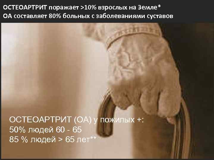 ОСТЕОАРТРИТ поражает >10% взрослых на Земле* ОА составляет 80% больных с заболеваниями суставов 50%