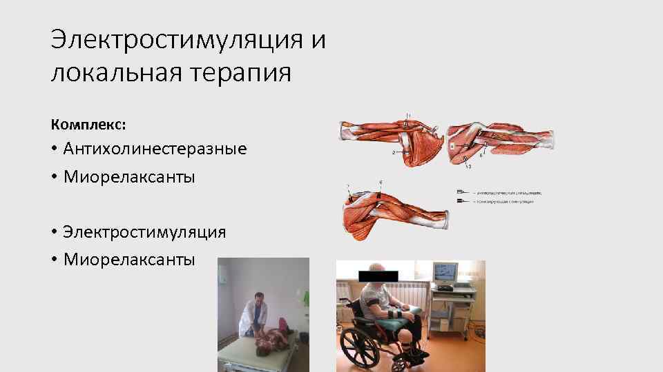 Электростимуляция и локальная терапия Комплекс: • Антихолинестеразные • Миорелаксанты • Электростимуляция • Миорелаксанты 
