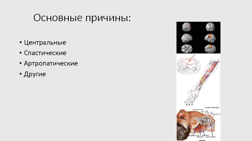 Основные причины: • Центральные • Спастические • Артропатические • Другие 