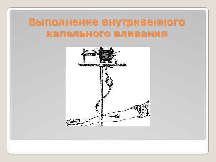 Выполнение внутривенного капельного вливания 