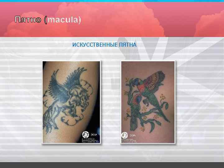 ИСКУССТВЕННЫЕ ПЯТНА 