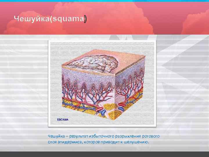 Чешуйка – результат избыточного разрыхления рогового слоя эпидермиса, которое приводит к шелушению. 