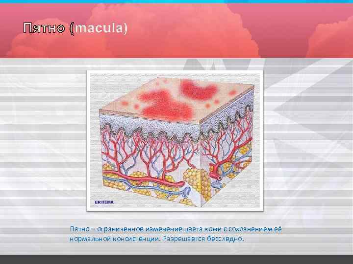 Пятно – ограниченное изменение цвета кожи с сохранением её нормальной консистенции. Разрешается бесследно. 